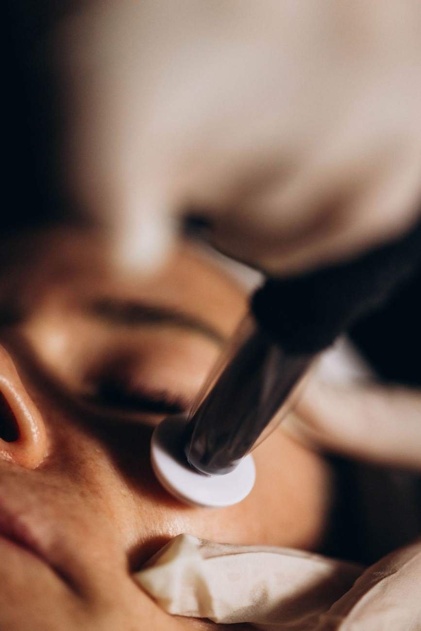 Procell Microchanneling Treatment